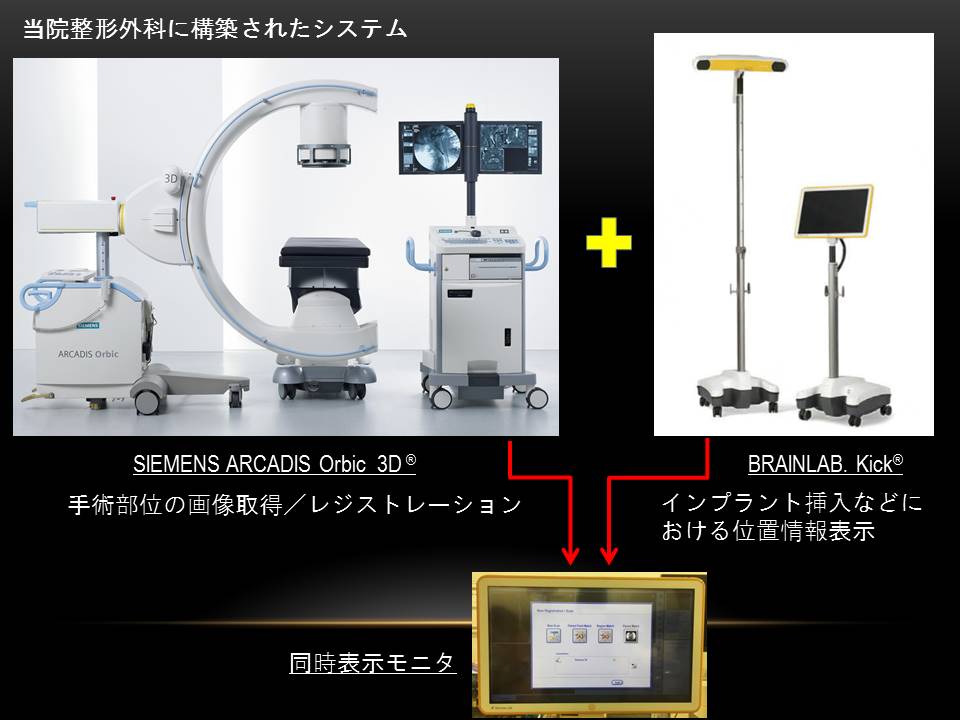 当院整形外科ナビゲーションシステム